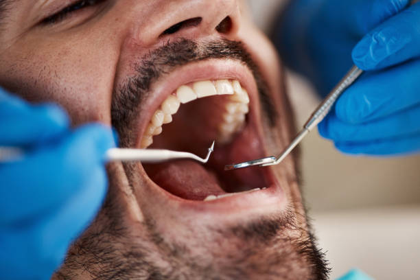 Best Emergency Denture Repair in Fairmont, NC